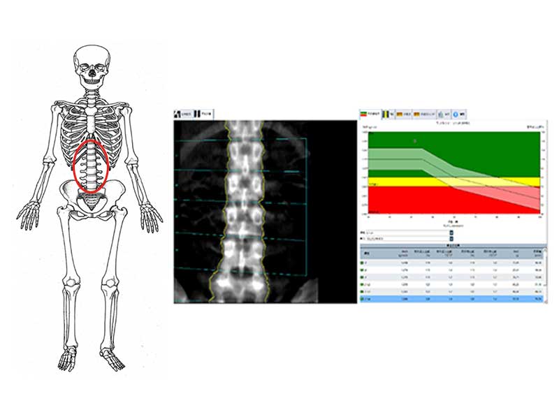 学会推奨の検査部位である腰椎とどちらかの大腿骨を計測し、正確な診断、経過観察をおこないます。